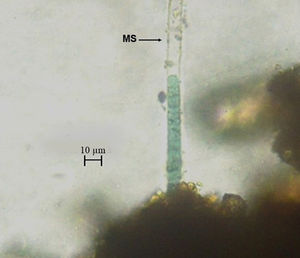 Phormidium nigrum (Vaucher ex Gomont) with a mucilaginous sheath (MS) associated with soil particles from the analyzed samples.