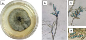 Macro (A) and micro morphology (B, C and D) of colonies of Setosphaeria turcica showing a blackened colony with gray aerial hyphae with circular shape and irregular edges (A), a solitary and thin conidiophore (B), with a knotty apex (B and C) from which clusters of elongated, oval, thin-walled, smooth, non-septate macroconidia emerge, containing 3–4 cells each (D).