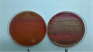 Aspecto de las colonias en (A) agar SS y en (B) agar EMB de Levine.