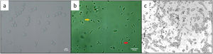 Observaciones microscópicas de muestras de cerveza contaminadas. a) 40x; se observan células con aspecto similar al de las levaduras de cervezas de tipo Ale (Saccharomyces cerevisiae). b) 100x; como morfologías bacterianas, se observan cocos (flecha amarilla) y bacilos (flecha roja). c) 40x; se observan células de levaduras diferentes a las levaduras cerveceras. El color de la figura solo puede apreciarse en la versión electrónica.