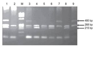 Agarose gel electrophoresis of PCR amplification products. The 480 bp band corresponds toGSTT1, 268 bp to β-globin and 215 bp to GSTM1. Lanes 1 and 3: GSTT1 positive/GSTM1 positive. Lanes 4, 5,6 and 8: GSTM1 positive/GSTT1 null. Lanes 7 and 9: GSTT1 positive/GSTM1 null. Lane2: GSTM1 null/GSTT1 null.M: φ 174/HaeIIII ladder