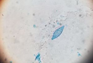 Micromorphology with fusiform macroconidia with more than 6 cellular divisions