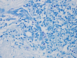 Mast cells stained with GIEMSA demonstrating intracytoplasmic granules in a 40x field