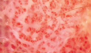 Detail of glomerular vessels, (X50)