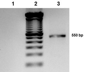 PCR amplification of the rDNA-ITS region: 1) Negative control; 2) Molecular weight marker 100bp ladder; and 3) C. langeronii isolate
