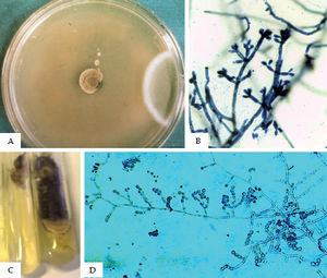 A -F. pedrosoi colony;B -F. pedrosoi microculture;C -C. carrionii colony;D -C. carrionii microculture