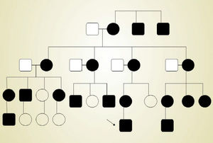 Heredogram: family members affected by the syndrome are represented by rectangles (men) or black circles (women). The patient is identified by the black arrow