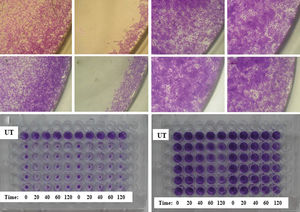Morphology of Balb/c 3T3 and HaCaT. Representative examples of untreated Balb/c on A - Nunc® and C - TPP® plates. Balb/c washed twice and incubated for 40 min in PBS on B - Nunc® and D - TPP® plates. Representative examples of untreated HaCaT on E - Nunc® and G - TPP® plates. HaCaT washed twice and incubated for 40 min in PBS on F - Nunc® and H - TPP® plates. Representative example of I - Balb/c 3T3 and J - HaCaT on TPP® plate. After 2 washes with PBS and incubation for 0, 20, 40, 60 or 120 min in PBS, cells were incubated for 24 hours and then fixed with methanol and stained with crystal violet dye. UT = untreated cells