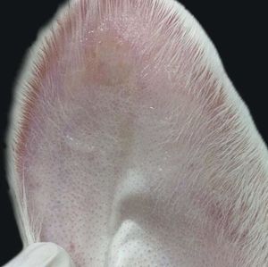 Wound macroscopy 30 days after the experiment. Wound treated with tacrolimus 0.1%: reduced thickness and less erythema than in controls