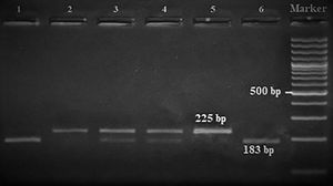 GNLY rs7908 gene polymorphism gel electrophoresis image. DNA marker is 100 bp. Samples with 3,4 are GC; samples with 1, 6 are CC and 2, 5 with GG genotype