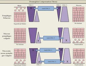 Desmoglein compensation theory. The different distribution patterns of Dsg1 and Dsg3 in the skin and mucosa are represented. In pemphigus foliaceus, anti-Dsg1 IgG antibodies cause superficial blisters on the skin, as Dsg3 compensates for non-functioning Dsg1 in the deep epidermis; there are no mucosal lesions, since adhesion is mediated mainly by Dsg3. In mucosal pemphigus vulgar-is, anti-Dsg3 IgG antibodies do not cause skin damage because Dsg1 compensates for Dsg3 dysfunction; however, there is a mucosal lesion because, unlike the skin, the low concentration of Dsg1 in the mucous membranes is not enough to compensate for Dsg3 dysfunction. In mucocutaneous pemphigus, the presence of anti-Dsg1 and anti-Dsg3 IgG antibodies causes lesions on both the skin and the mucosa