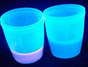 Pink-reddish fluorescence of urine exposed to Wood’s light (left) compared to control urine (right)