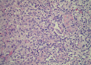 Histopathology with hematoxylin & eosin staining, ×40.