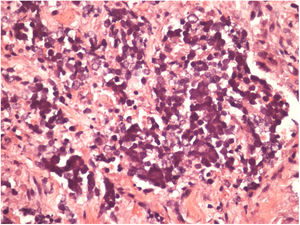 Detail of the Merkel cells (Hematoxylin & eosin, x200).