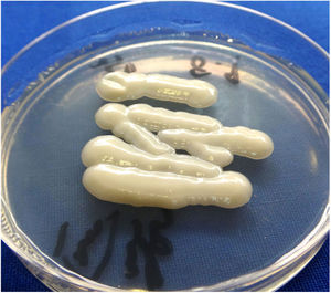 The cultured microorganism. Shiny, light-yellow mucoid colonies on Sabouraud