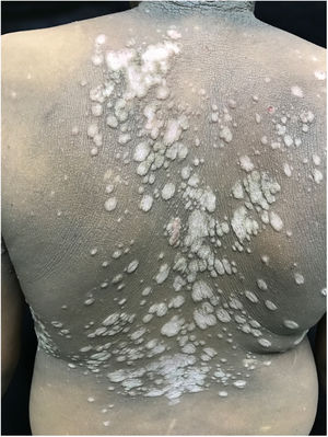 Details of the lesions.