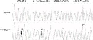 Sequence chromatogram of the heterozygous variants of IL36RN in palmoplantar pustulosis.