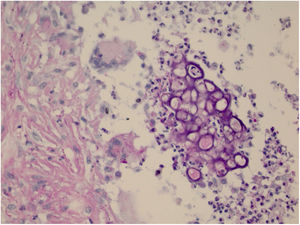 The sporangia appear stained by PAS (x400).