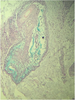 Mucin in the outer root sheath of the hair follicle (Alcian Blue, ×100).