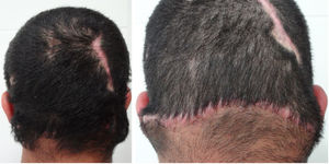 Patient with clinical aspect after treatment.