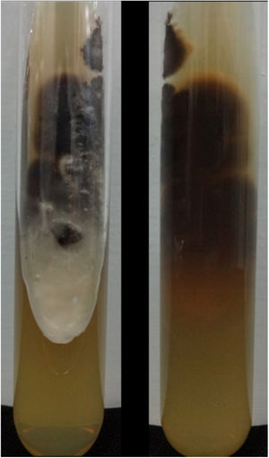 Membranous colony with white and blackened areas, and colorless back.