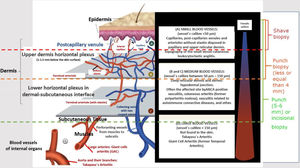 Schematic representation of the skin (epidermis, dermis and subcutaneous tissue), types of blood vessels found in upper and lower dermis vascular plexus, vessels diameter, site of main vasculitis syndromes and sufficient depth of biopsies to represent the skin layer in which the disease is localized.