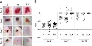 Re-epithelialization. (A) Clinical follow-up of cutaneous abrasions. (B) Quantification of re-epithelialization (by the abrasion healing rate [AHR]) treated with saline (S), antiseptic solution (AS), and latex serum (SLX). ANOVA statistical test, Bonferroni post-test. *Corresponds to a significant difference (p<0.05).