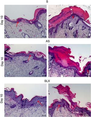 Photomicrography of the exulcerated areas. Photomicrography of the exulcerated areas treated topically with saline (S), antiseptic solution (AS), or latex serum (SLX) on the 10th day of follow-up; samples were stained with hematoxylin–eosin (HE), highlighting the amount of crust and the thickness of the epidermis with a worse and a better photomicrograph in each group and treatment. The red arrows indicate the thickness of the epidermis (magnification: 100×).