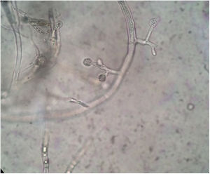 Slide culture revealed spherical sporangia, long and hyaline hyphae, and rhizoids with no distinguishable stolons (×400).