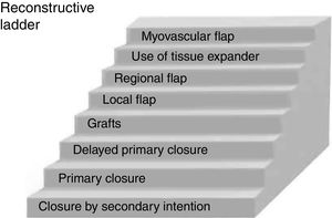 “Reconstructive ladder” demonstrating the simplest to the most complex closures in reconstructive surgery.