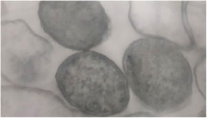 Transmission electronmicroscopy photomicrograph of a colony of Bartonella henselae (ATCC 49793) after 45 days of growth on blood-enriched agar: cocoid and electrondense bacteria with a tri-laminar wall, 50,000×.
