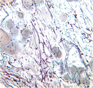 Numerous thick hyphae are observed (Grocott-Gomori stain, ×10).