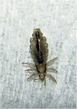 Pediculus humanus capitis. Causal agent of pediculosis of the scalp, endemic in large urban agglomerations.