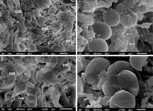 Scanning electron microscopy: (A and B) fragmented tissue resembling pebbles or stones (arrows) between the collagen fibers (col). (×2,700 and ×4,300). (C) Detail of four structures resembling pebbles or stones; the upper one is curved, similar to Fig. 3A, and a granular deposit is seen on the right (arrows) (×8,500). (D) Detail of the deposits resembling pebbles or stones (×7,500).