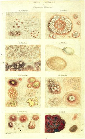 Illustrations of dermatological diseases by Robert Willan (1808). Source: On Cutaneous Diseases.49