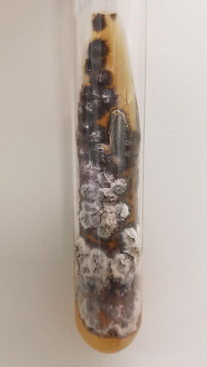 Ocular secretion culture in Sabouraud agar, showing the growth of a black and white filamentous colony.