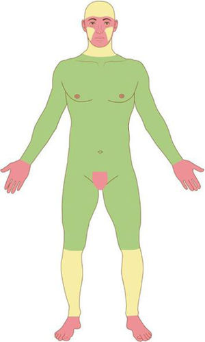Anatomic risk areas. Red: High-risk areas. central face, eyelids, eyebrows, periorbital skin, nose, lips, chin, mandible, preauricular and postauricular skin, temple area, ear, genitalia, hands, and feet. Yellow: Medium-risk areas. cheeks, forehead, scalp, neck, and pretibial. Green: Low-risk areas. Trunk and extremities (excluding hands, feet, nail units, pretibial area, and ankles).