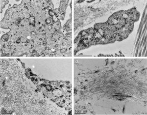 Transmission electron microscopy – (A and B), Presence of fibrillar material inside a cell (×25,000 and ×40,000). (C and D), High magnifications detailing the fibrillar nature of the deposits (×50,000 and ×50,000).
