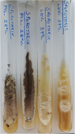 Culture tubes with Agar Sabouraud. Filamentous form (25 °C) with gray to black membranous colonies. Yeast form (37 °C) with beige creamy colonies forming ridges from the center outward.