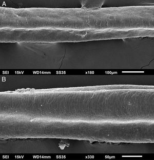 Scanning electron microscopy - Eyelash examination - small (A) and medium magnification (B), showing grooves in the hair shaft (×180, ×330).