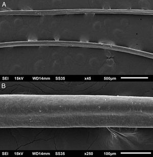 Scanning electron microscopy - Hair examination - small (A) and medium magnification (B), showing grooves in the hair shaft (×45, ×250).