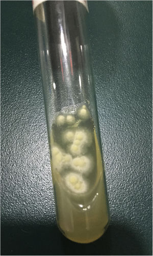 The colonies of fungal culture.