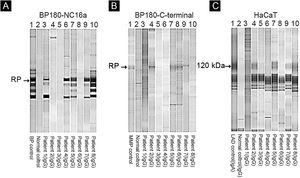 Immunoblot using BP180-NC16a (A), BP180 C-terminal (B), and HaCaT cells (C) with serum samples. For positive results see the RP (reference protein) from: BP (Bullous Pemphigoid) patient
