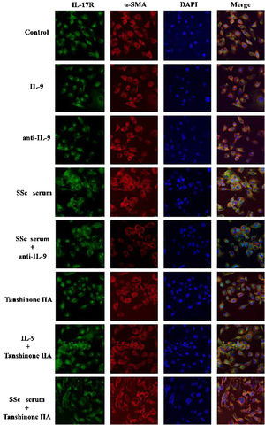 IL-9 neutralizing antibody and Tanshinone IIA inhibit the expression of IL-17R in DVSMCs. α-SMA, red fluorescence; IL-17R, green fluorescence.