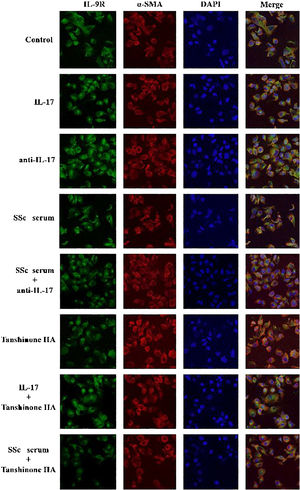 IL-17 neutralizing antibody and Tanshinone IIA inhibit the expression of IL-9R in DVSMCs. α-SMA, red fluorescence; IL-9R, green fluorescence.