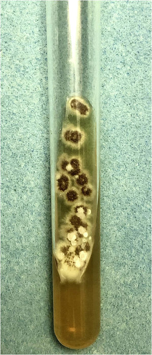 Culture on modified Sabouraud agar medium with macromorphology showing a black filamentous colony with a white halo.