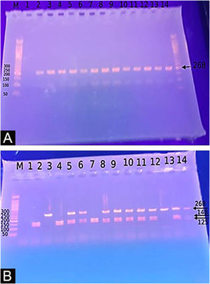 (A) Agarose gel electrophoresis images PCR product: 268-bp. (B) Agarose gel electrophoresis images for DEFB1 SNPs G20A, AA genotype: 268-bp, GG genotype: 143-bp, 125-bp, AG genotype.