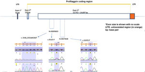 Schematic picture of the FLG gene including the distribution of exons, size of exons, introns, indication of profilaggrin coding region, position of primers and electropherograms of the three most frequent pathogenic variants found in the present sample.