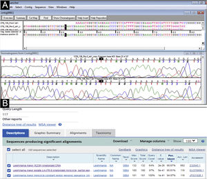 Analysis of DNA sequencing of the PCR product with specific primers for a kinetoplast minicircle DNA region (mitochondrial DNA or kDNA) of Leishmania spp. (A) Assembling and editing of the sequences, one sense strand (forward) and two antisense strands (reverse), using the Sequencher™ software and observation of the chromatograms or electropherograms. (B) Comparative analysis performed by aligning the consensus sequence with nucleotide sequences deposited in GenBank-NCBI (BLASTn ‒ blast.ncbi.nih.gov.qBlast.cgi). The sequencing allowed the molecular identification of the Leishmania major species complex (BLASTn=Similarity or Maximum Identity: >95%, fragment size: 117bp).