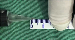 Demonstration of the needle reach when the Cheyenne device is used